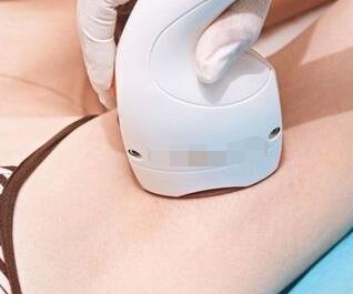激光脫毛有用嗎？激光脫毛是永久性的嗎？