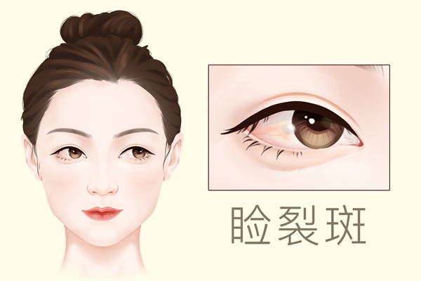 怎樣祛斑快效果好