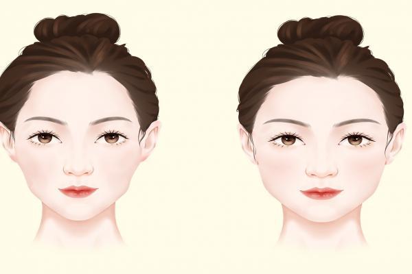 臉部過敏發(fā)紅發(fā)癢怎么辦