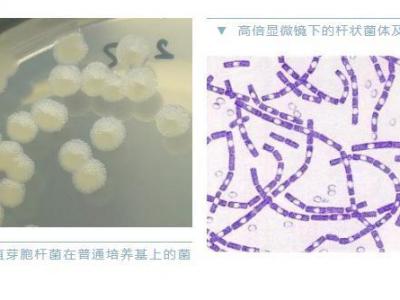 警惕炭疽，和新冠同一等級(jí)傳染病！