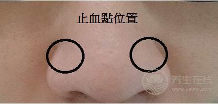 秋季流鼻血更加頻繁，怎樣才能有效止血呢?