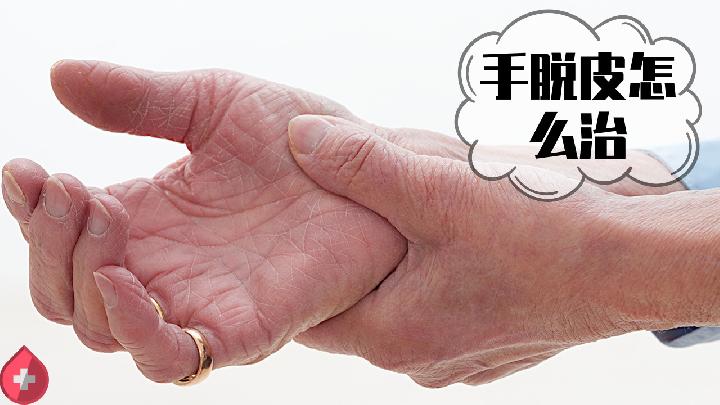 冬天手上皮膚發黑?5種原因要了解-易網健康<a href=http://m.aoa7937.com/jkys/ target=_blank class=infotextkey>養生</a>網 冬天手上皮膚發黑?5種原因要了解