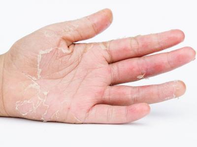 冬天腳冷怎么辦？睡前熱水泡腳