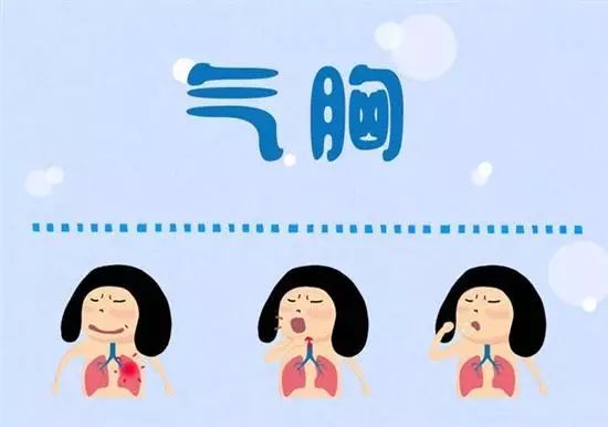 20個生活中的急救常識