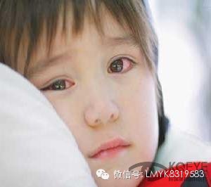 慢性結膜炎的原因有哪些? 慢性結膜炎的原因有哪些?