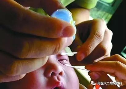 頻繁眨眼，小心是眼病信號(hào)