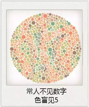 與視力相關的一些眼疾 與視力相關的一些眼疾