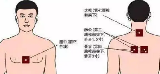 三伏貼貼什么位置圖-易網<a href=http://m.aoa7937.com/ target=_blank class=infotextkey>健康養生</a>網 三伏貼貼什么位置圖