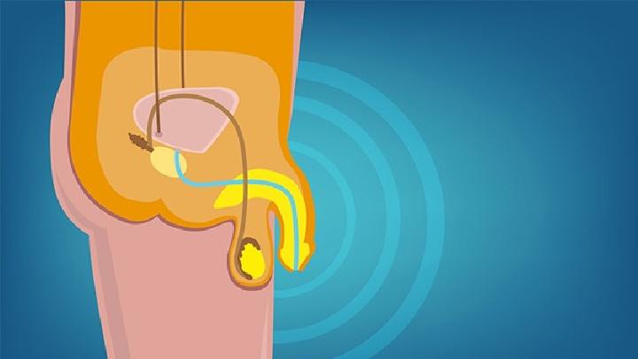 男性陰囊濕疹怎么用針灸治療 男性陰囊濕疹的針灸治療方法-易網(wǎng)<a href=http://m.aoa7937.com/ target=_blank class=infotextkey>健康養(yǎng)生</a>網(wǎng) 男性陰囊濕疹怎么用針灸治療 男性陰囊濕疹的針灸治療方法