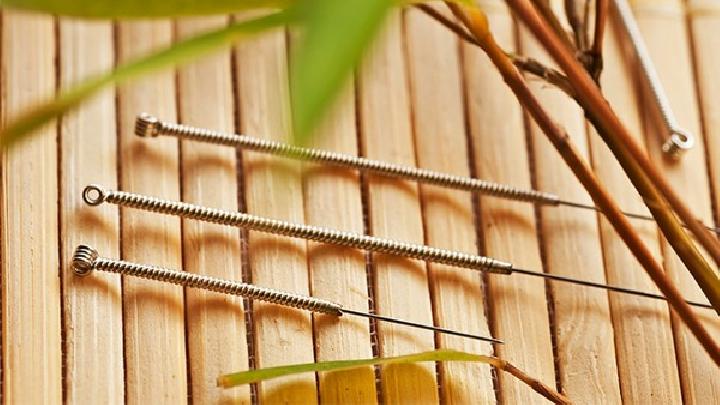 治療耳鳴用的針灸方法是怎樣的 專家解讀中醫(yī)針灸治耳鳴的方法