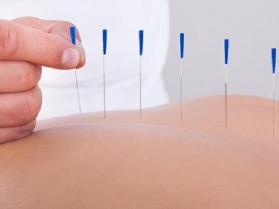 中醫(yī)針灸如何治療乳腺增生 關(guān)于針灸乳腺增生的治療方法介紹
