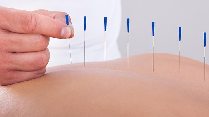 導致女性痛經的原因是什么？女性緩解痛經可試針灸治療